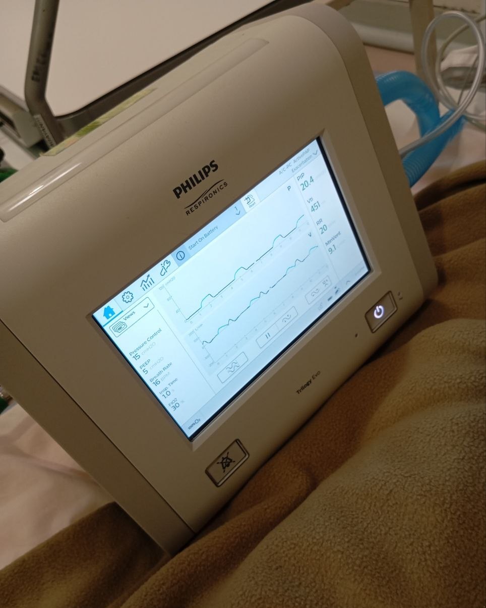 Angled close view of a Philips Trilogy Evo display and control panel.